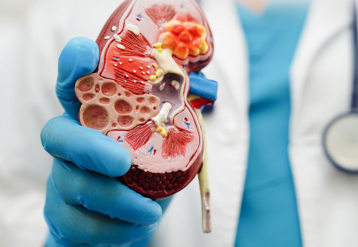 Nephrology medicine manufacturing